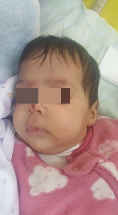 התינוקת נפצעה בפניה (צילום: ורד דפנה)